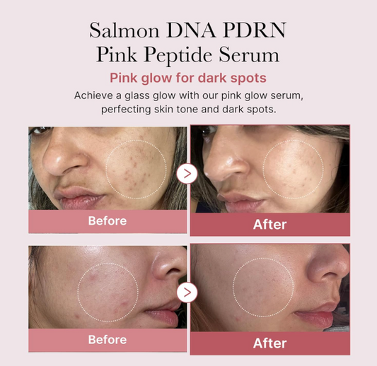 PDRN Pink Peptide Serum 30ml