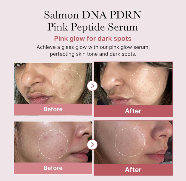PDRN Pink Peptide Serum 30ml
