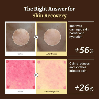 Advanced PDRN Rejuvenating Cream 20ml