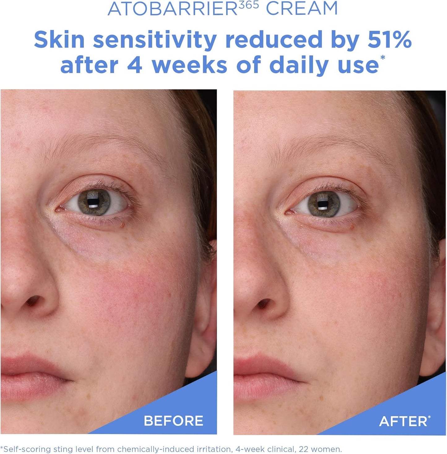 Atobarrier 365 Cream 80ml