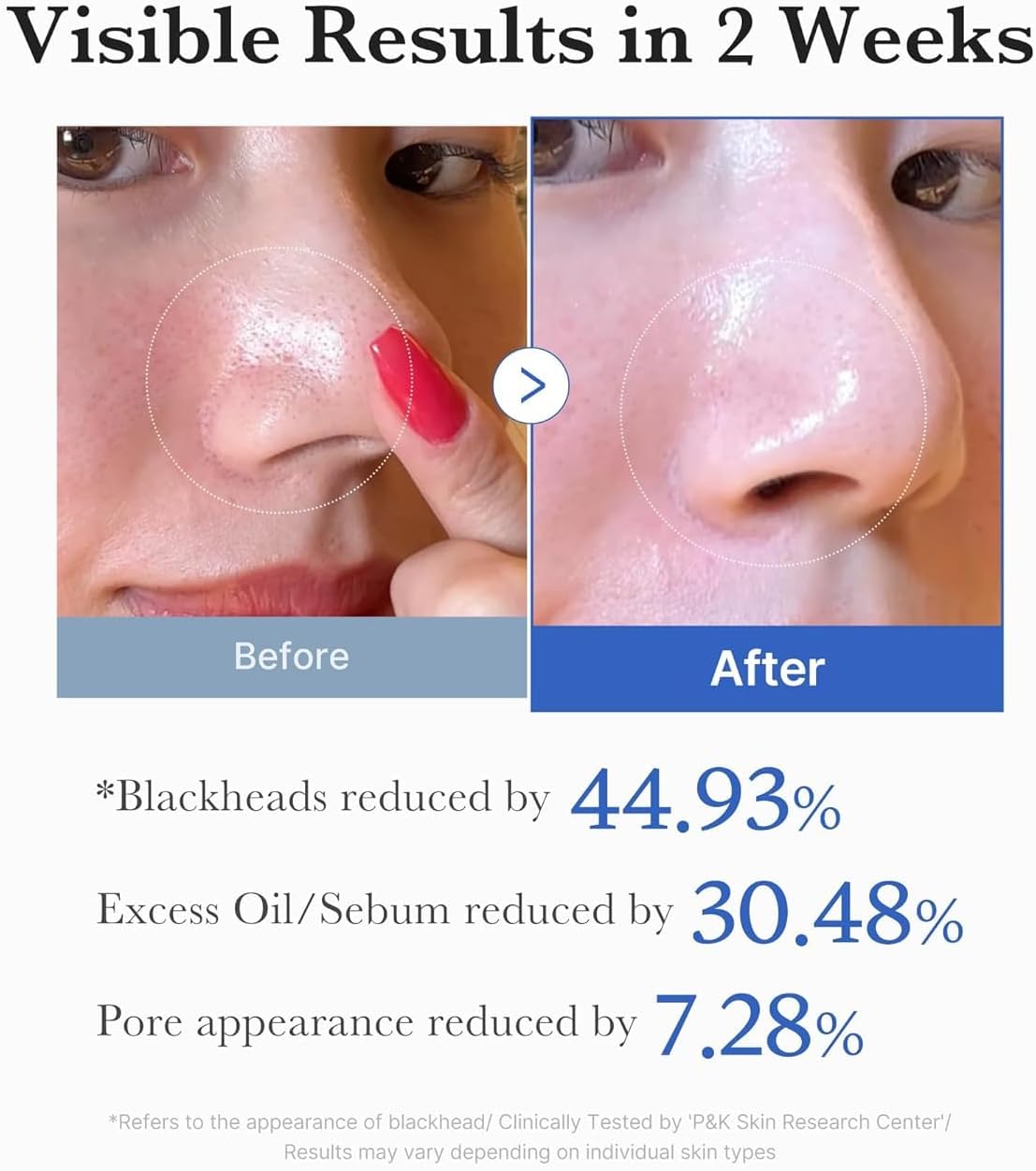 Zero Pore Pad 2.0 (70pcs)