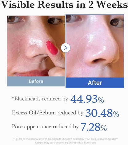 Zero Pore Pad 2.0 (70pcs)