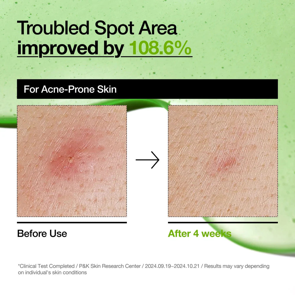 Azelaic Acid 10 Hyaluron Redness Soothing Serum 30ml